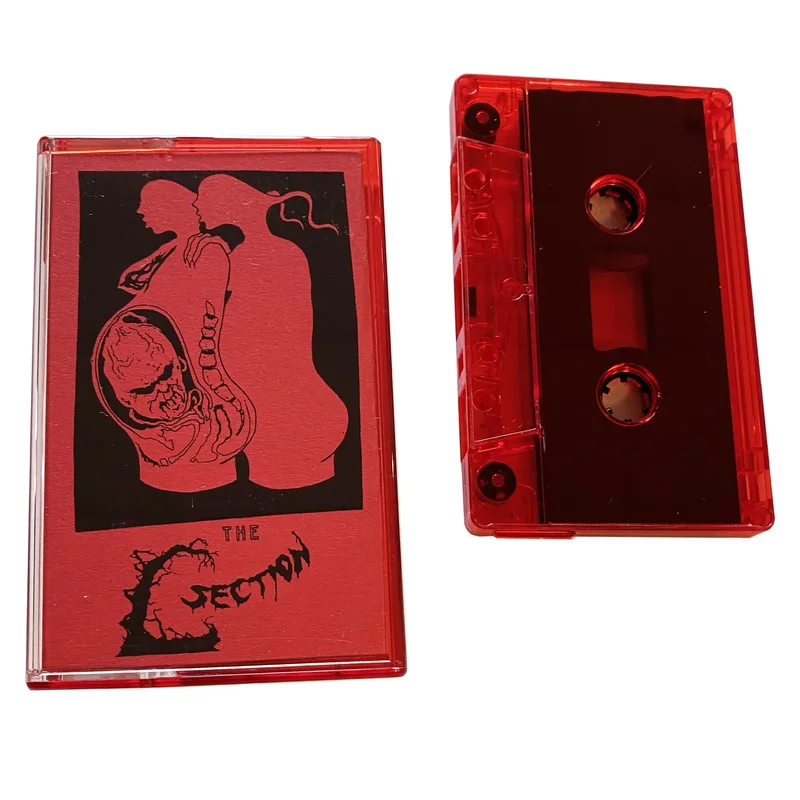 The C-Section: S/T cassette