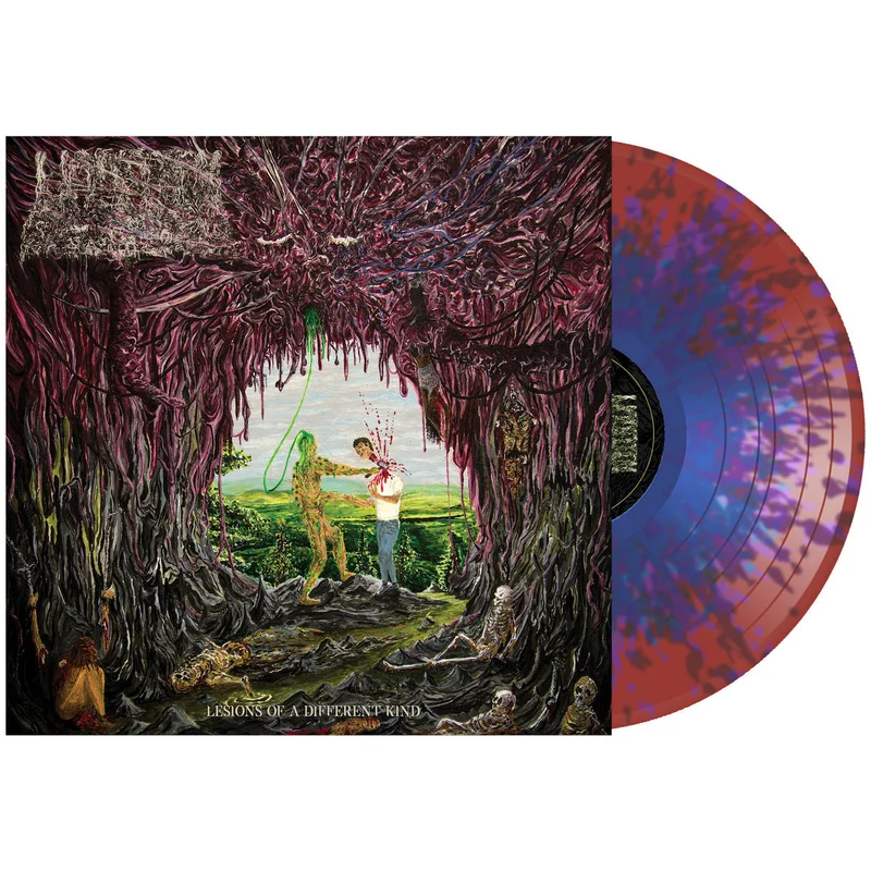 UNDEATH 'LESIONS OF A DIFFERENT KIND' LP - CLEAR/DARK RED/LIGHT BLUE/SPLATTER