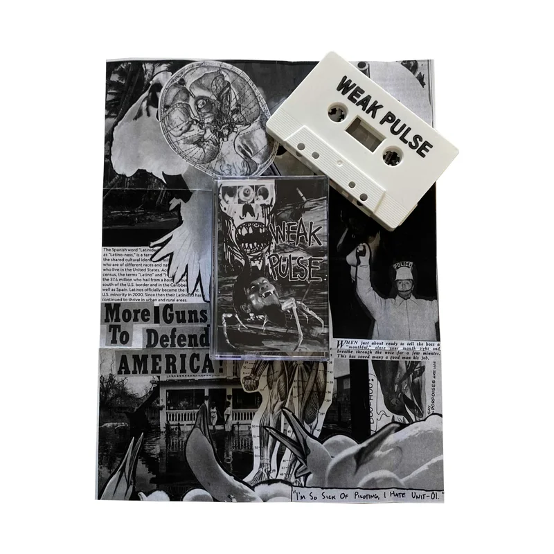 Weak Pulse: EKG cassette